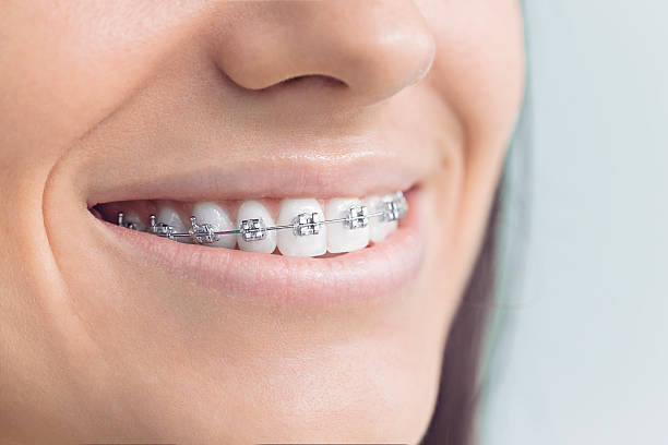 Best Wisdom Tooth Removal  in Arapahoe, WY